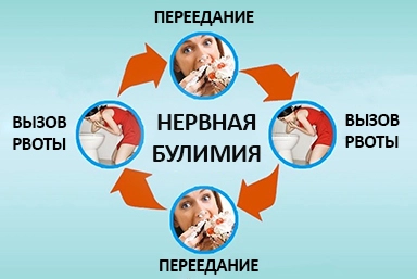 Лечение булимии в Нестеровской